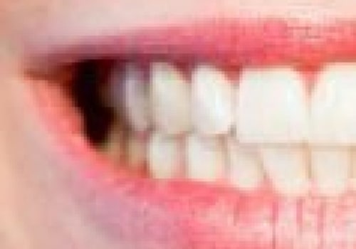 How Coffee Stains Teeth and How to Whiten Them